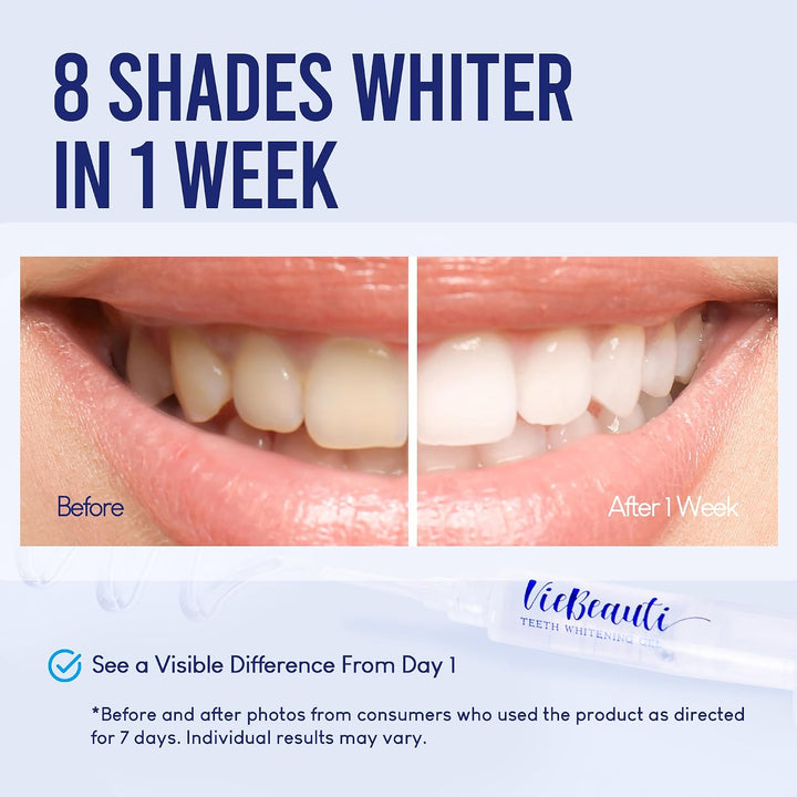 VieBeauti Kit de blanqueamiento dental con luz LED para dientes sen...