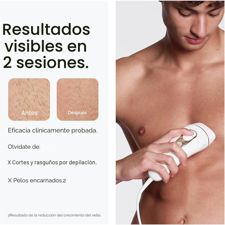 Braun Smart IPL, Silk·Expert Pro 5: Dispositivo de Depilación Láser...