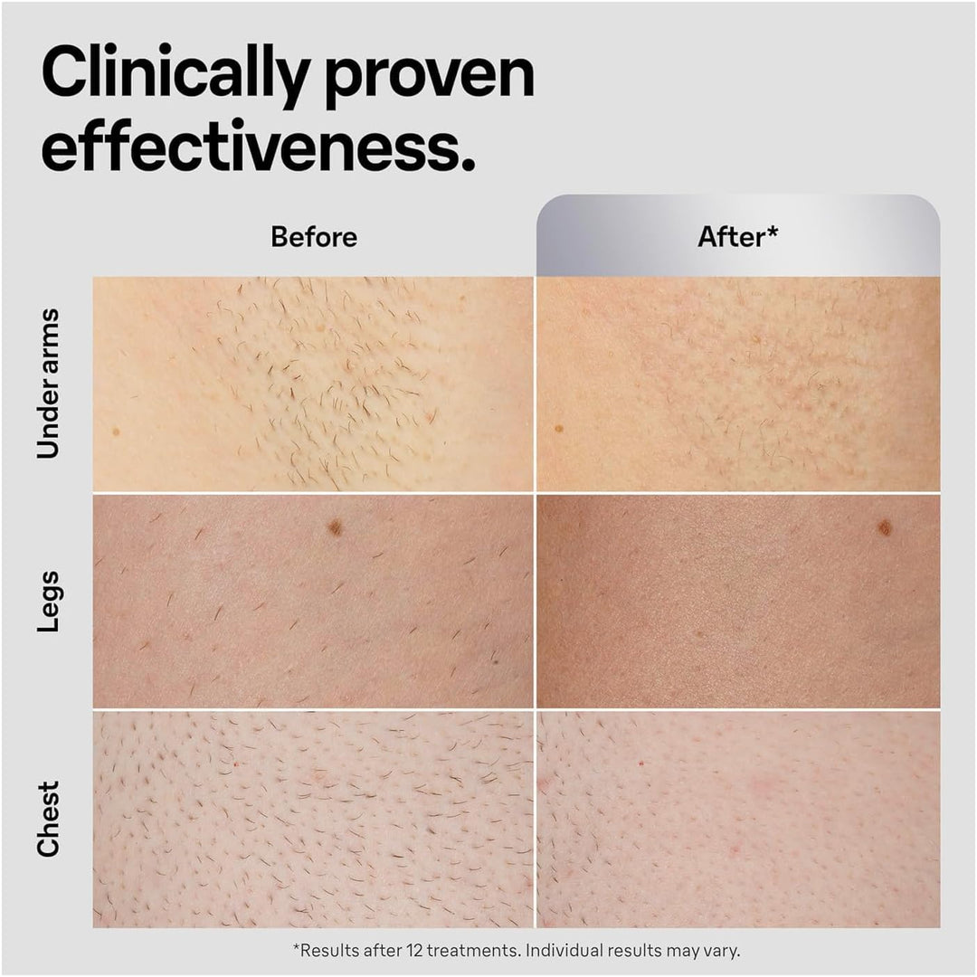 Braun Smart IPL, Silk·Expert Pro 5: Dispositivo de Depilación Láser...