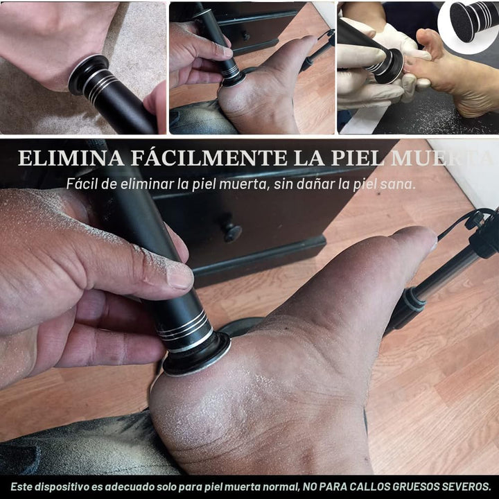 Removedor de callos eléctrico mejorado para pies (velocidad ajustab...