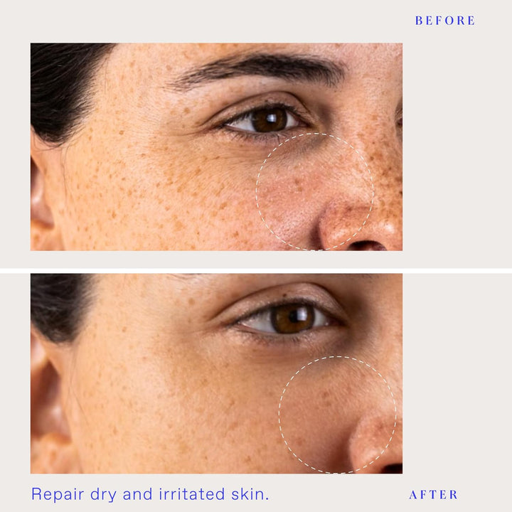 BioRepublic Máscara InvisaMask ultra calmante para rostro, con escu...