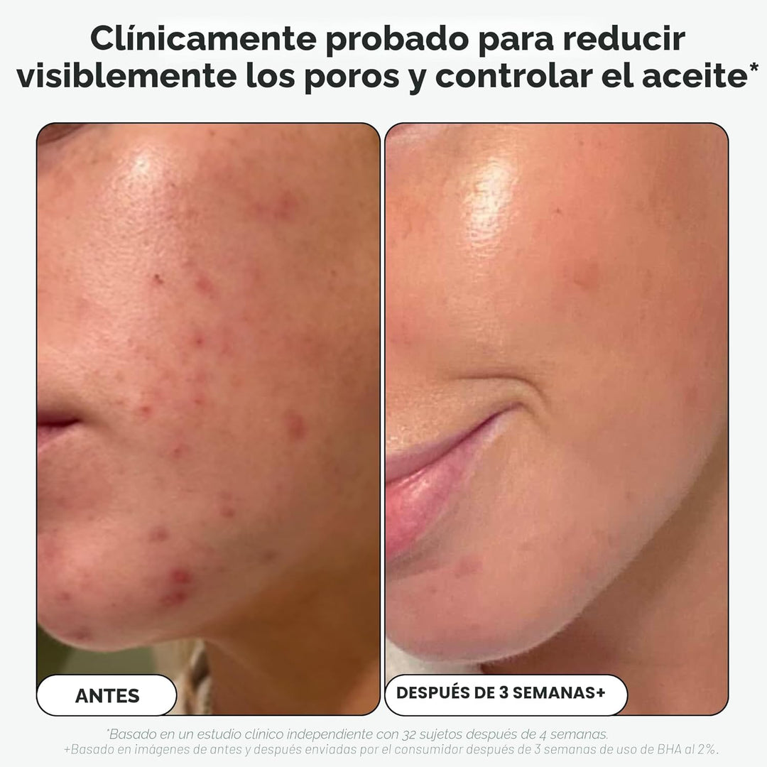 Paula's Choice Skin Perfecting - Exfoliante líquido de ácido sa...