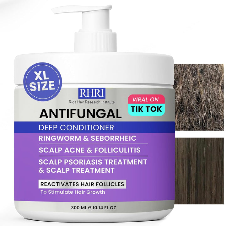 Acondicionador profundo antifúngico para hombres y mujeres | Tratam...