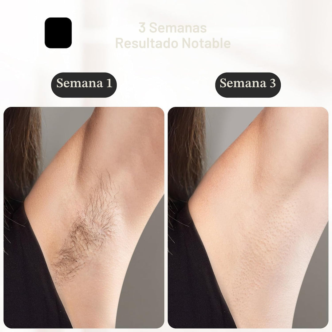 JOVS Depilación láser, [energía 24J] Depilación IPL para mujeres y...