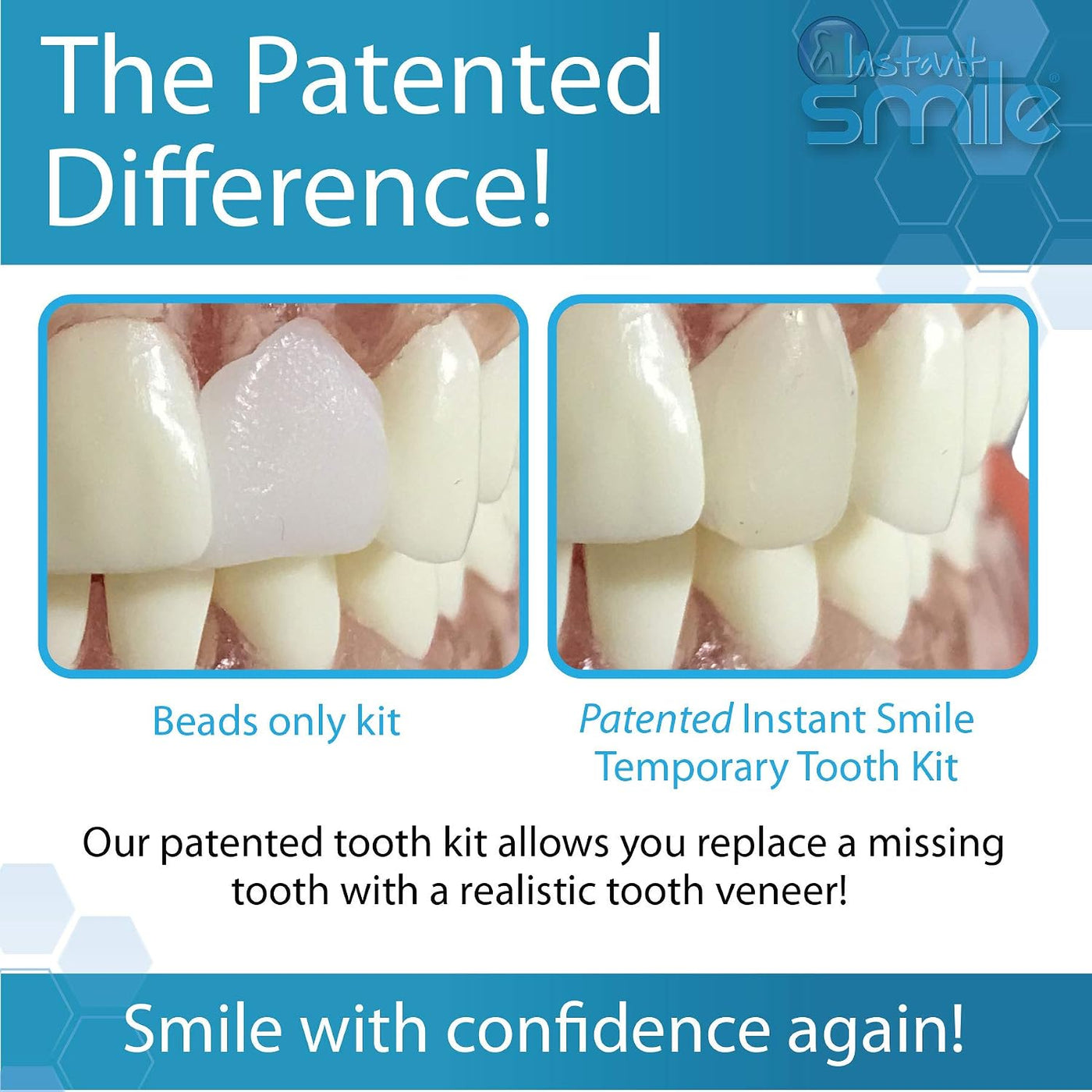 Instant Smile Complete su kit de reemplazo temporal de dientes de s...