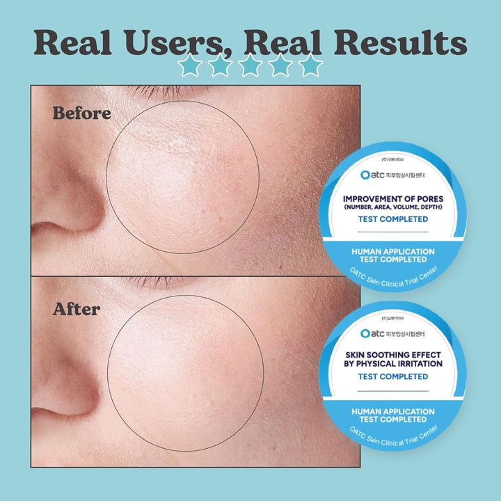 Jung Beauty Carboxy - Máscara facial y cuello con terapia de CO2, p...