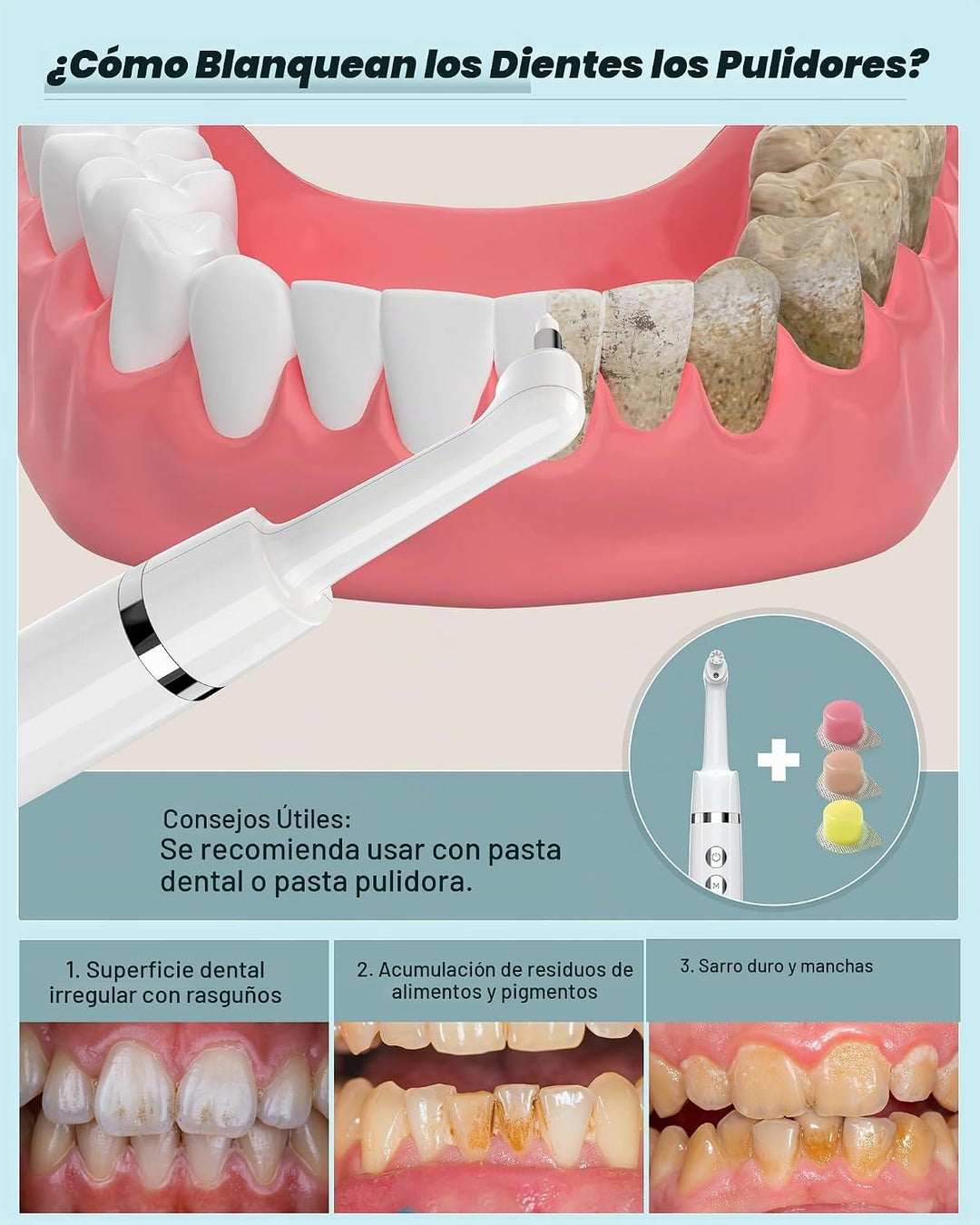Pulidor de Dientes, Kit Recargable de Blanqueamiento Dental para Li...