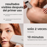 Nood™ NUEVO Flasher Pro \u2014 Dispositivo de depilación láser IPL...