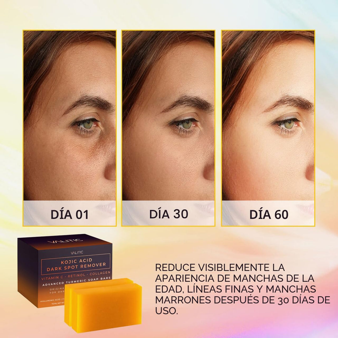 VALITIC - Jabón con ácido kójico, vitamina C, retinol, colágeno, cú...