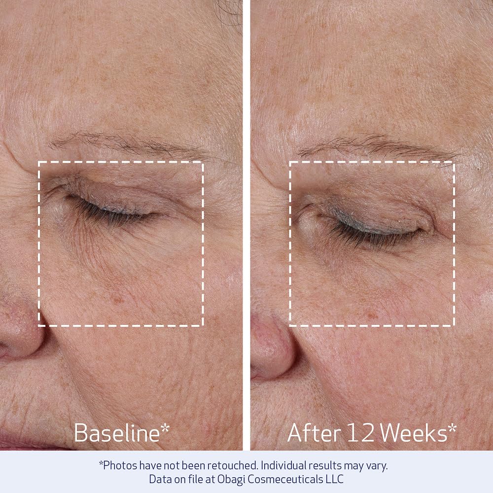 Obagi ELASTIderm Lift Up &amp; Sculpt - Crema facial antienvejecimi...