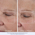 Obagi ELASTIderm Lift Up & Sculpt - Crema facial