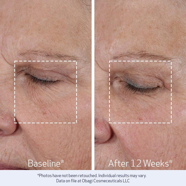 Obagi ELASTIderm Lift Up &amp; Sculpt - Crema facial antienvejecimi...
