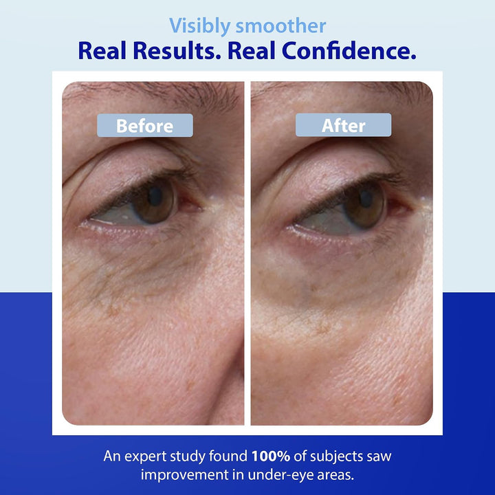 Dr. Denese SkinScience Crema facial reafirmante de colágeno para oj...
