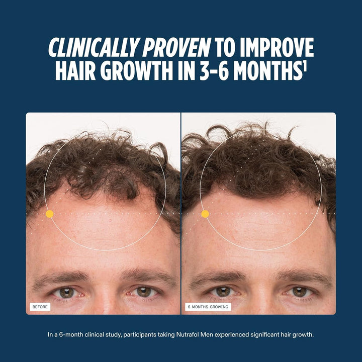Nutrafol Men's Hair Growth Supplements, Clinically Tested for V...