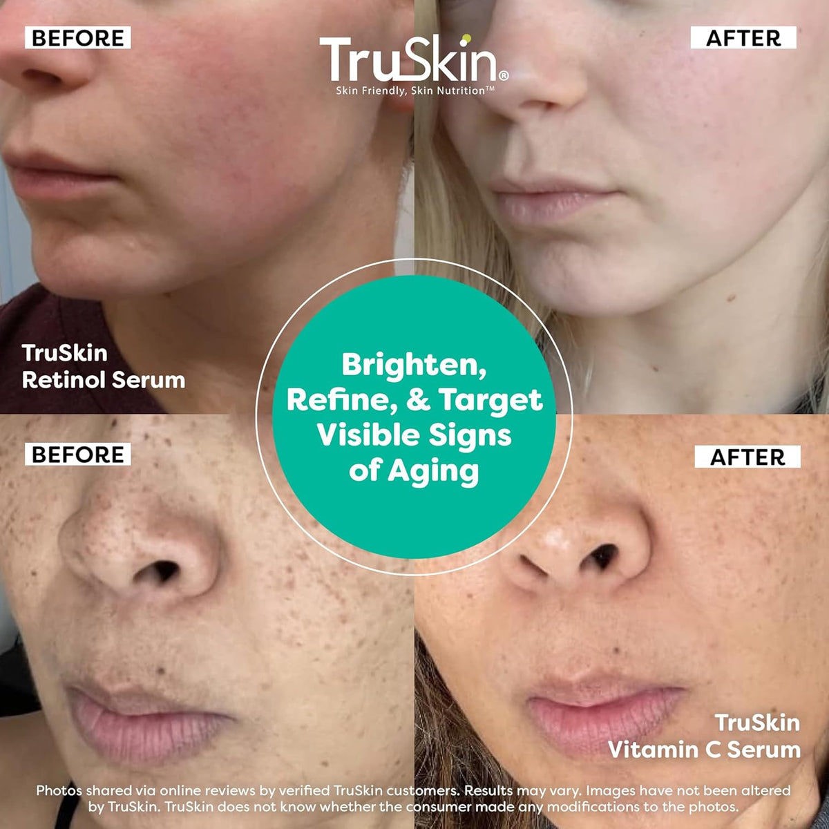 TruSkin Naturals Suero facial Duo - Suero de retinol para la cara y...