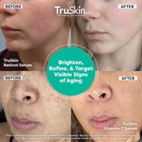 TruSkin Naturals Suero facial Duo - Suero de retinol para la cara y...