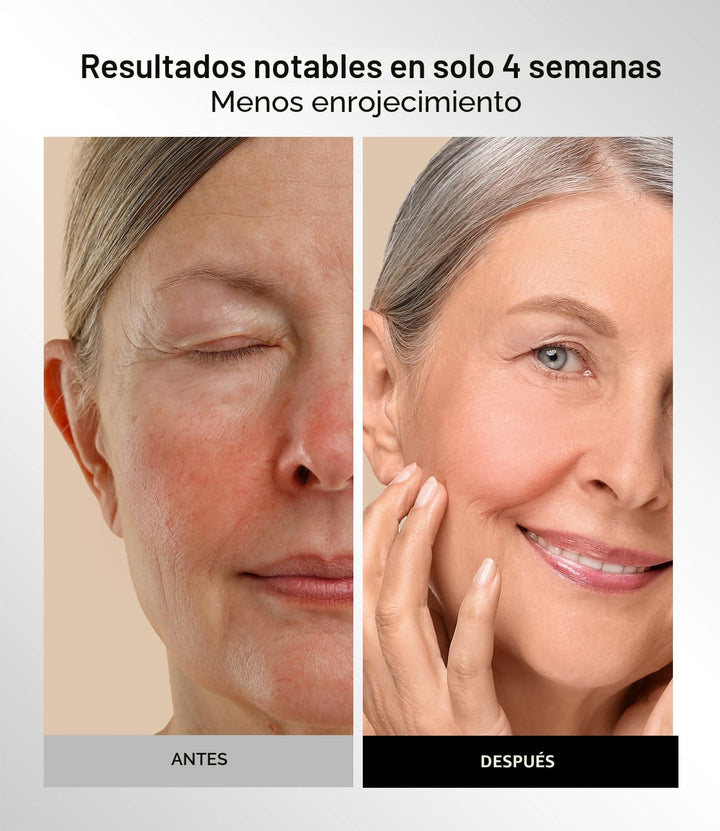 Máscara de terapia de luz roja para cara y cuello, 4 modos de luz c...
