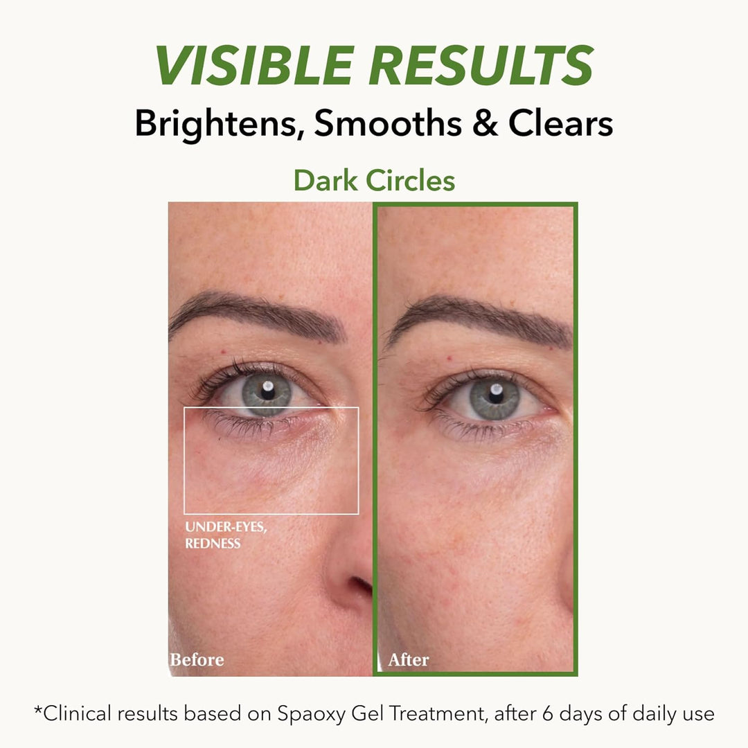 Dr. MEDION Spaoxy - Máscara de gel Matcha Clear Plus con CO2, trata...