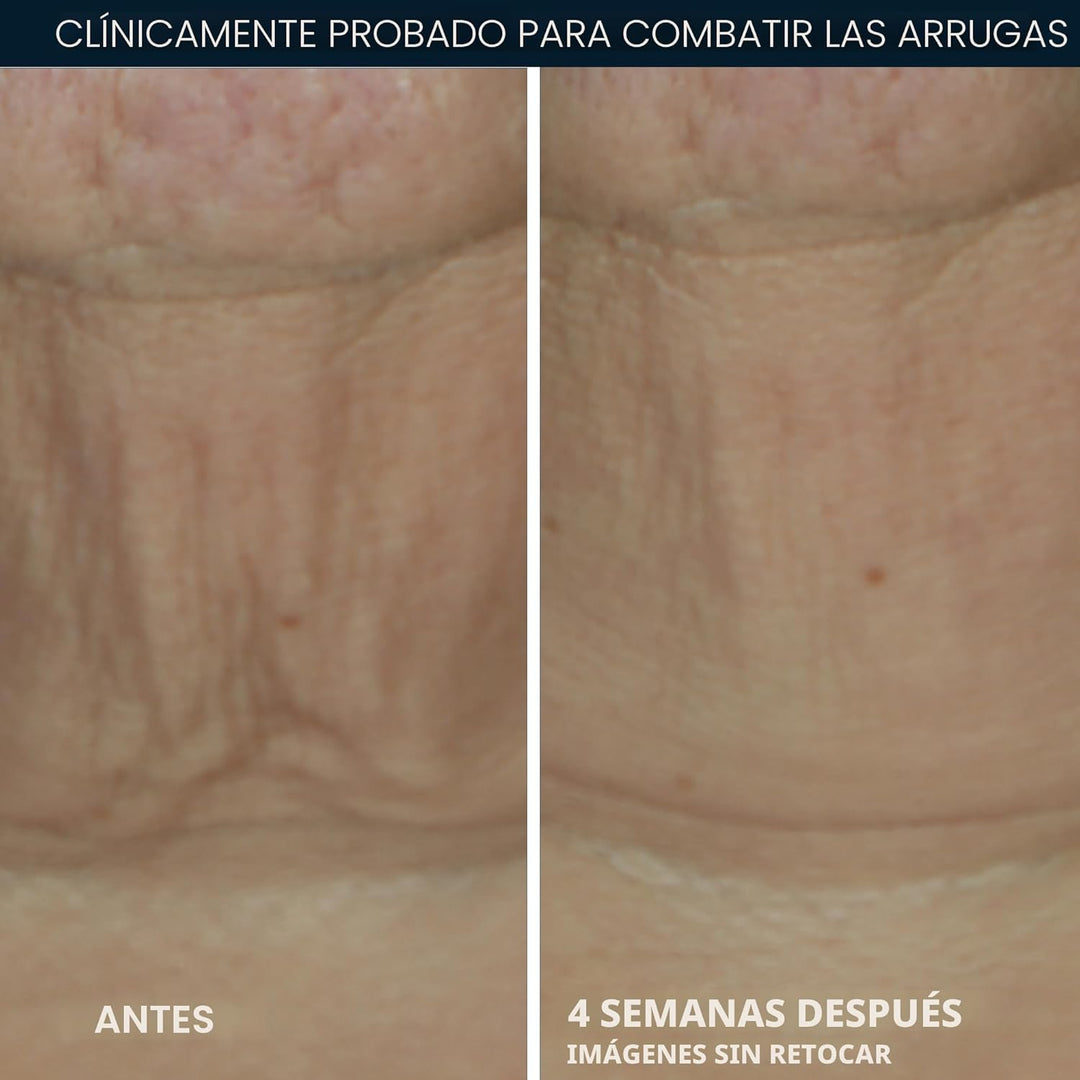 RoC Derm Correxion Retinol suero reafirmante en barra con antioxida...