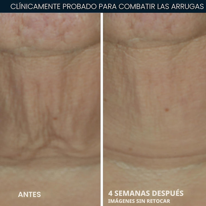 RoC Derm Correxion Retinol suero reafirmante en barra con antioxida...