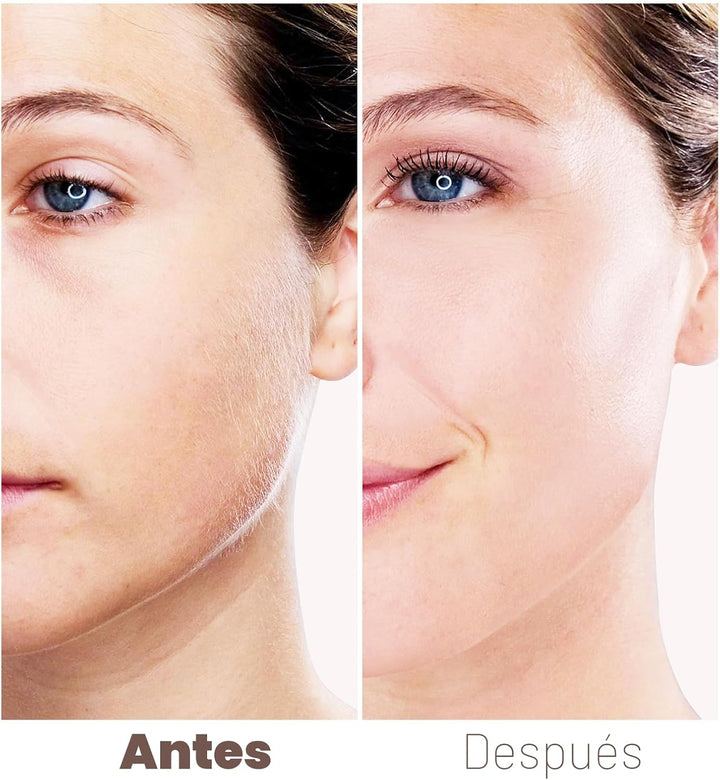 Depilación facial para mujeres, dispositivo removedor de vello sin...