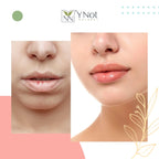 YNN Emu Oil - Bálsamo labial hidratante con protección solar extrem...