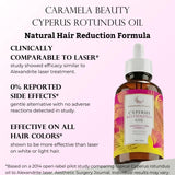 Aceite de Cyperus Rotundus Natural Caramela Beauty - 60ml de Aceite...