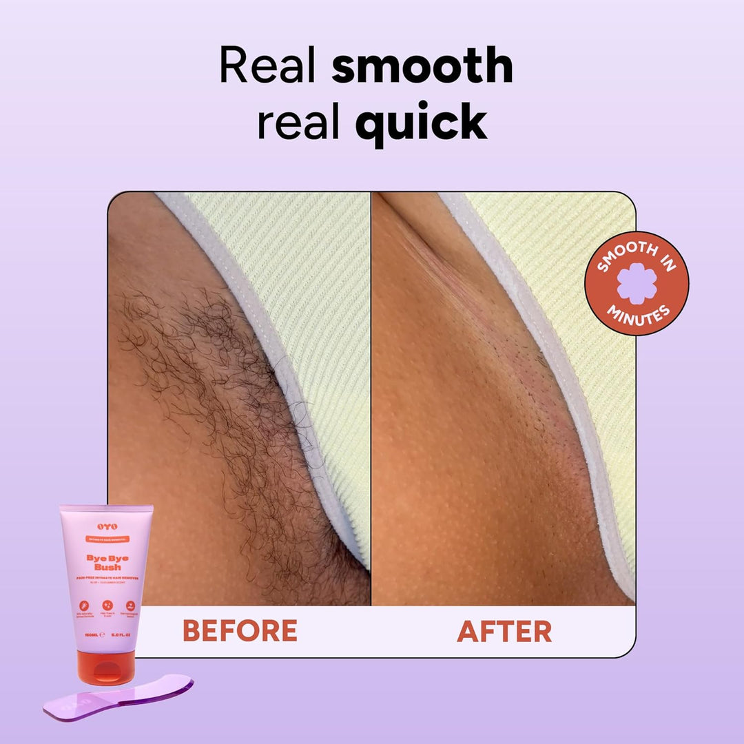 Bye Bye Bush by OYO - Crema depiladora para mujeres para área priva...