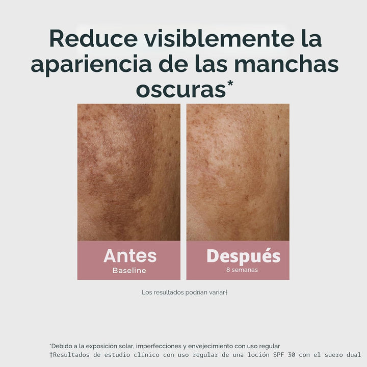 Eucerin Radiant Tone - Suero dual corrector de manchas oscuras, sue...