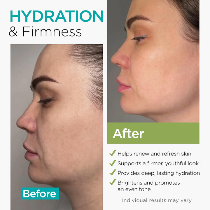 Crema de Colágeno NAD+ para Rostro con Retinol Ácido Hialurónico Ni...