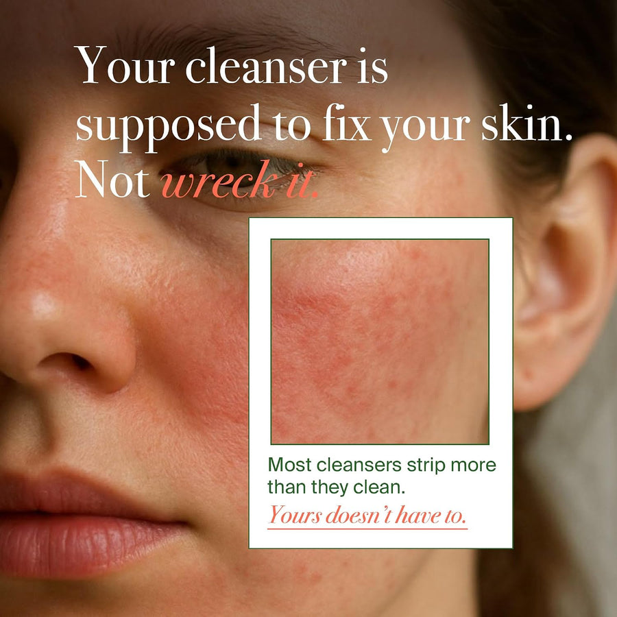 VELVENTE Matcha Rose PDRN - Jabón facial coreano, limpiador hidrata...