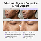MAREE Crema facial de ácido tranexámico - Crema con alfa arbutina,...