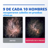 Rogaine para hombres 5% Minoxidil para hombres en espuma, crecimien...