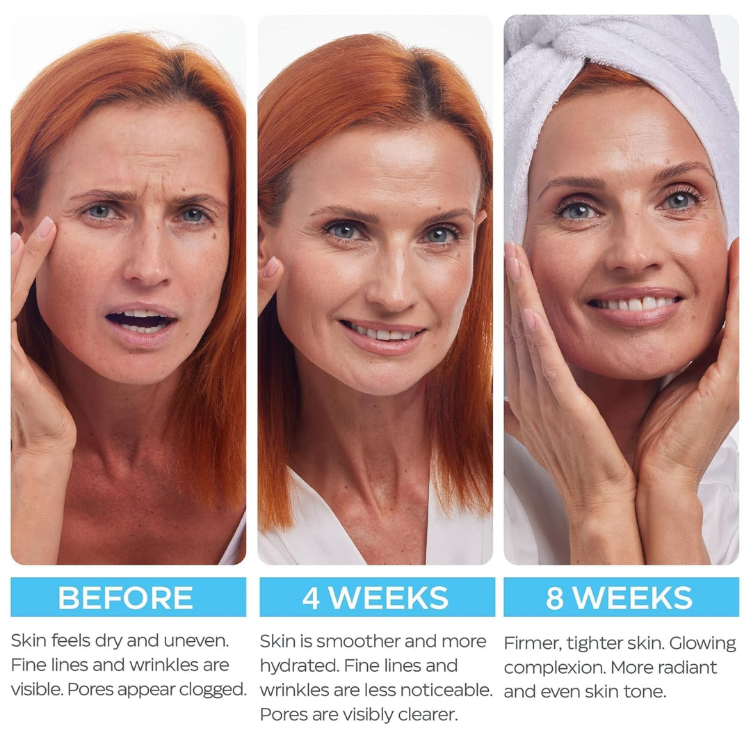 Retinol Cream for Face 2-Pack \u2013 Anti-Aging Moisturizer with Hy...