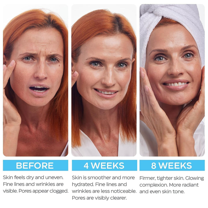 Retinol Cream for Face 2-Pack \u2013 Anti-Aging Moisturizer with Hy...