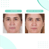Serious Skincare - Set de piel radiante glicólica - Mejora la apari...