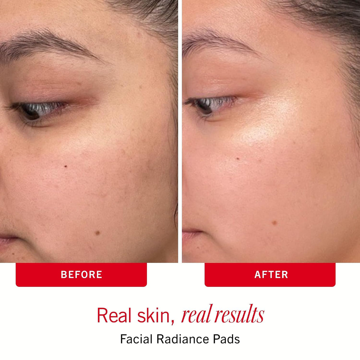 First Aid Beauty Juego de rutina para el cuidado de la piel sensibl...