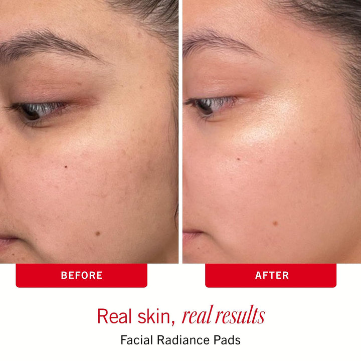 First Aid Beauty Juego de rutina para el cuidado de la piel sensibl...