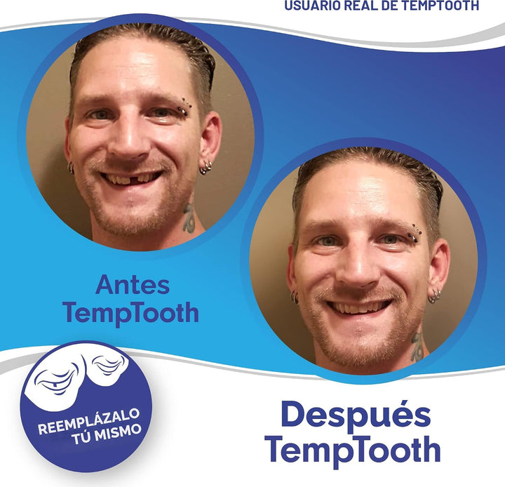 El producto de sustitución dentaria temporal n.'º 1 en ventas,...