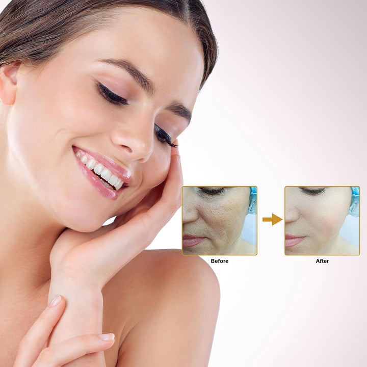 Elitzia Kit facial de CO\u2082 - 6 juegos\/caja para máquina facial...