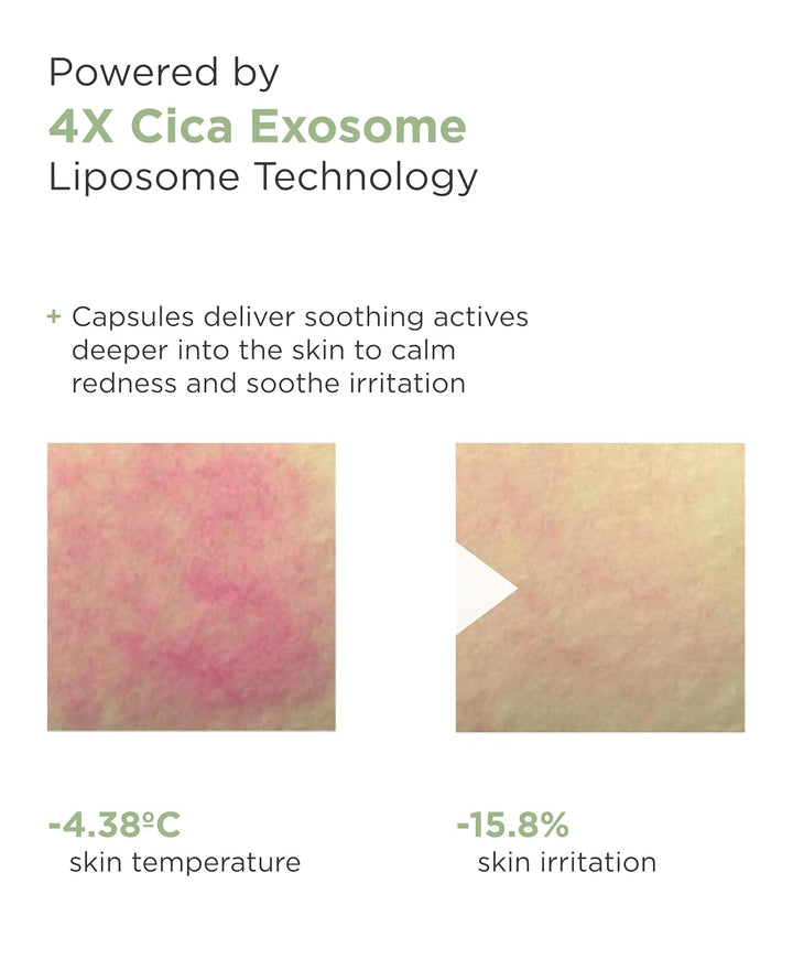AROCELL - Máscara facial de hidrogel Cica PDRN, 4 hojas faciales co...