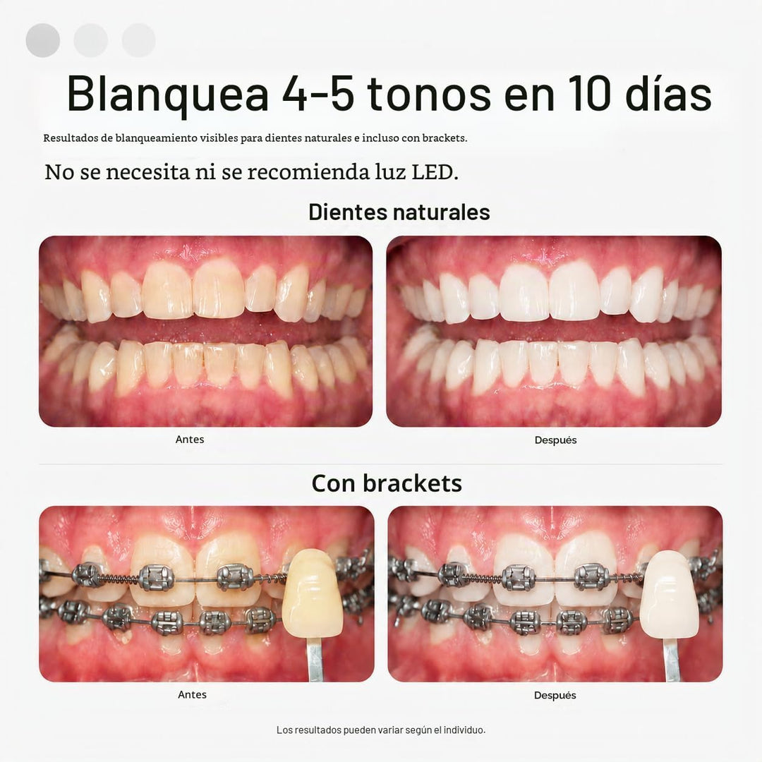 Opalescence Go 15 Mint - Bandejas blanqueadoras de dientes precarga...