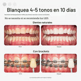 Opalescence Go 15 Mint - Bandejas blanqueadoras de dientes precarga...
