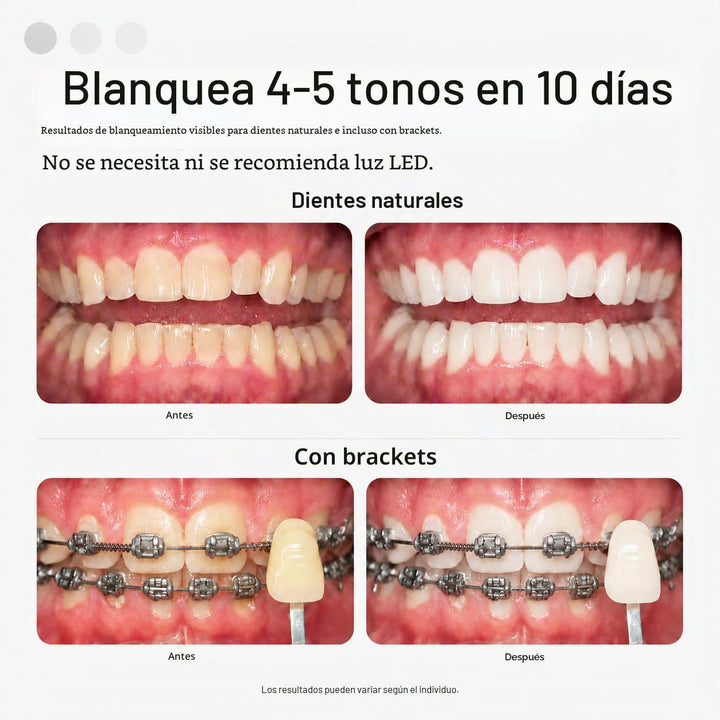 Opalescence Opalescence Go - Bandejas blanqueadoras precargadas con...