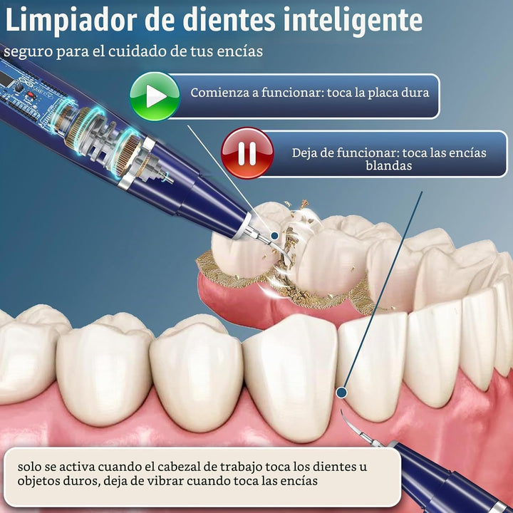 Removedor de placa para dientes, removedor de sarro para dientes, k...