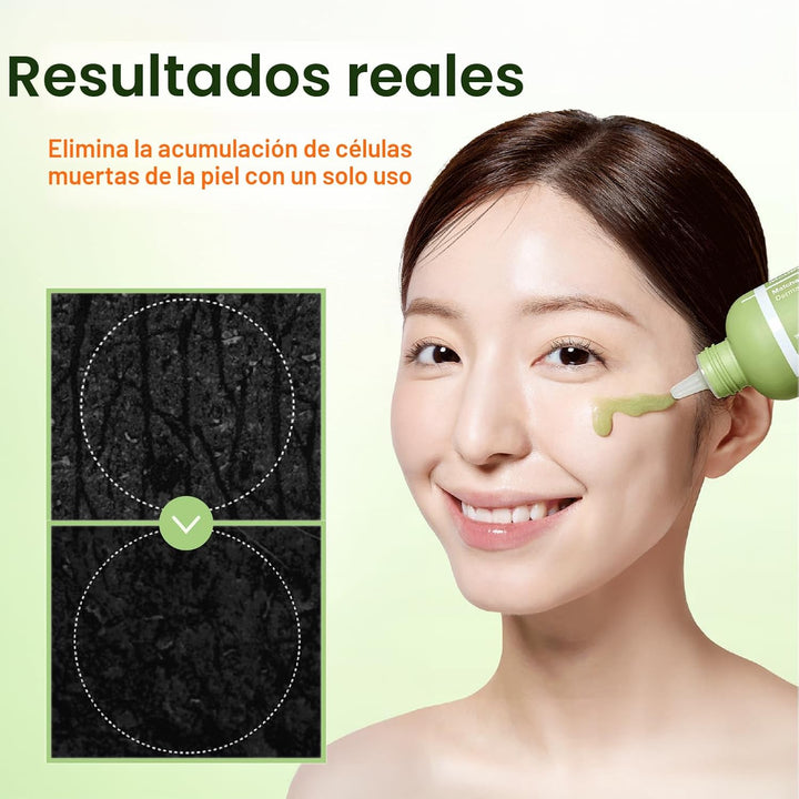 CENTELLIAN 24 Madeca Matcha Gel Peeling (5.07 fl oz) \u2013 Exfolia...
