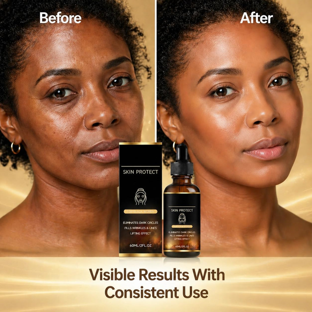 Walker Skin Protect Serum para mujeres negras, reduce arrugas y lín...