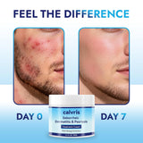 Calvris Scalp Comfort Balm - Fórmula botánica sin esteroides para c...