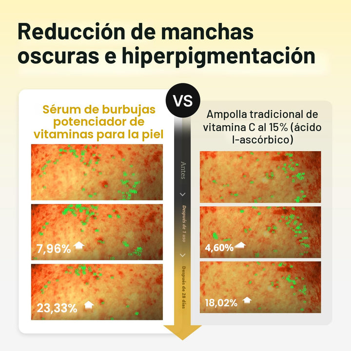 MEDITHERAPY Suero de vitamina C para la cara, fórmula de microburbu...