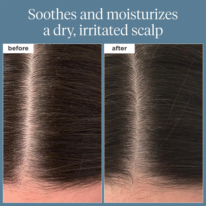 Briogeo Scalp Revival Rosemary Pre-Wash Oil | Moisturizing Scalp Tr...
